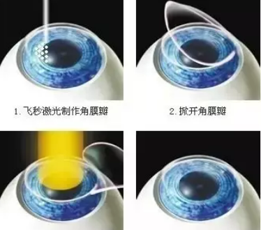 d4ffe89a76765868e119887a19dc24a.png