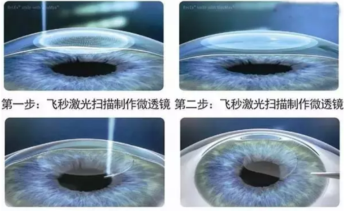 da6b956b9546d463ad0f118e8a185d1.png