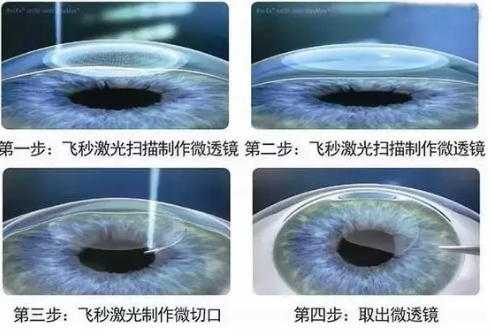 e0cea74d8847c188eb2a68230eafa9e.png