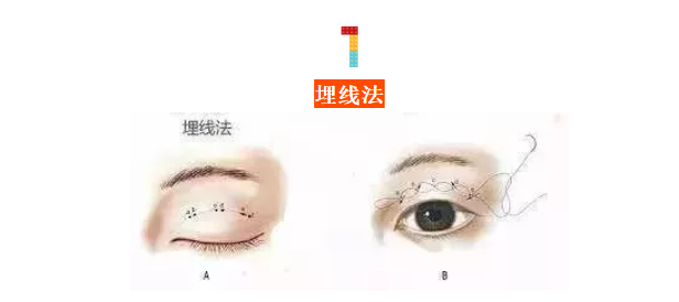 622897b08f40e782dc161386d4e37c4.png