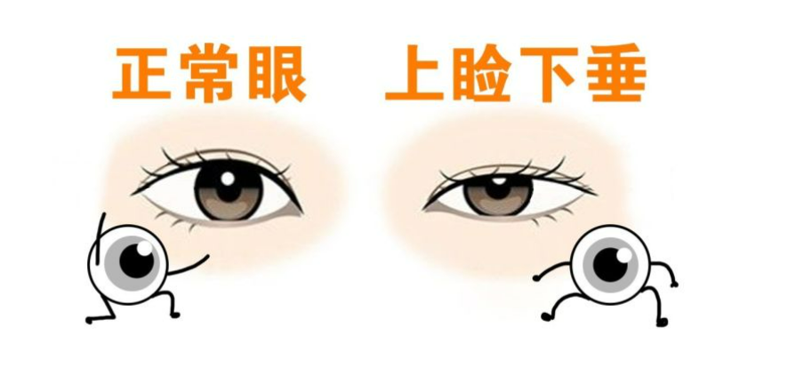 5142c587d35f29d315f2f3da1be21e6.png