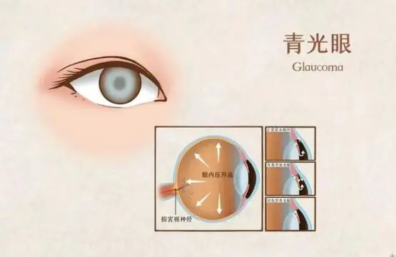 1752199686695844.png 微信图片_20250711100923.png