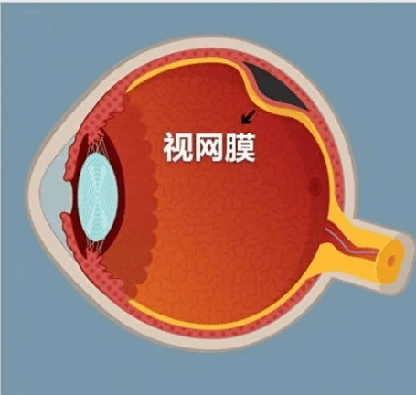 e86d39b89b998934acd537d790c52be.png