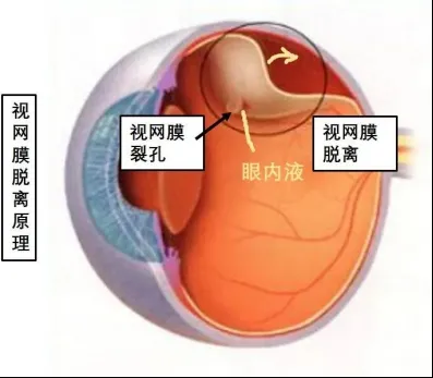 ee593e31073cacb85955fe9ef55c971.png
