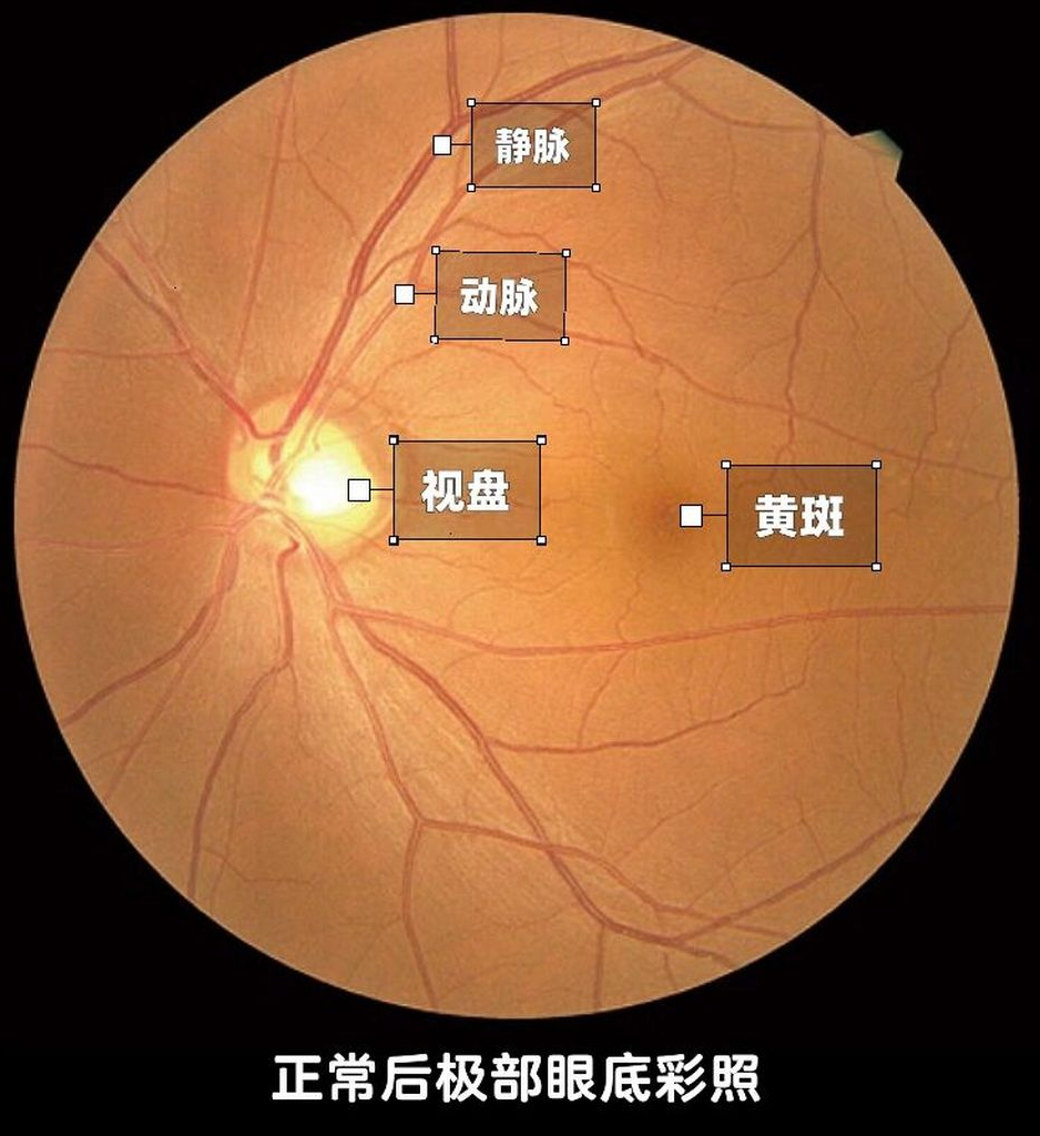 973d23f378a2e41607afb9001b88639.png