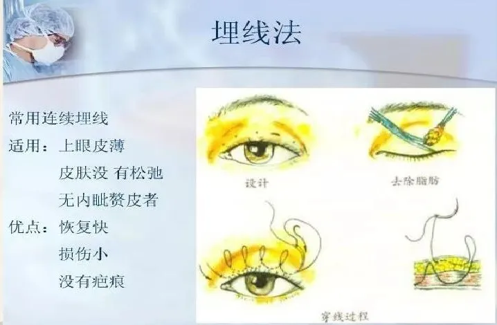 96db15f8b9534b8a7c5dbdf708722d7.png