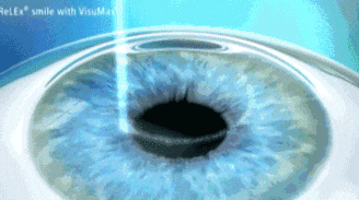 1761041780982679.gif