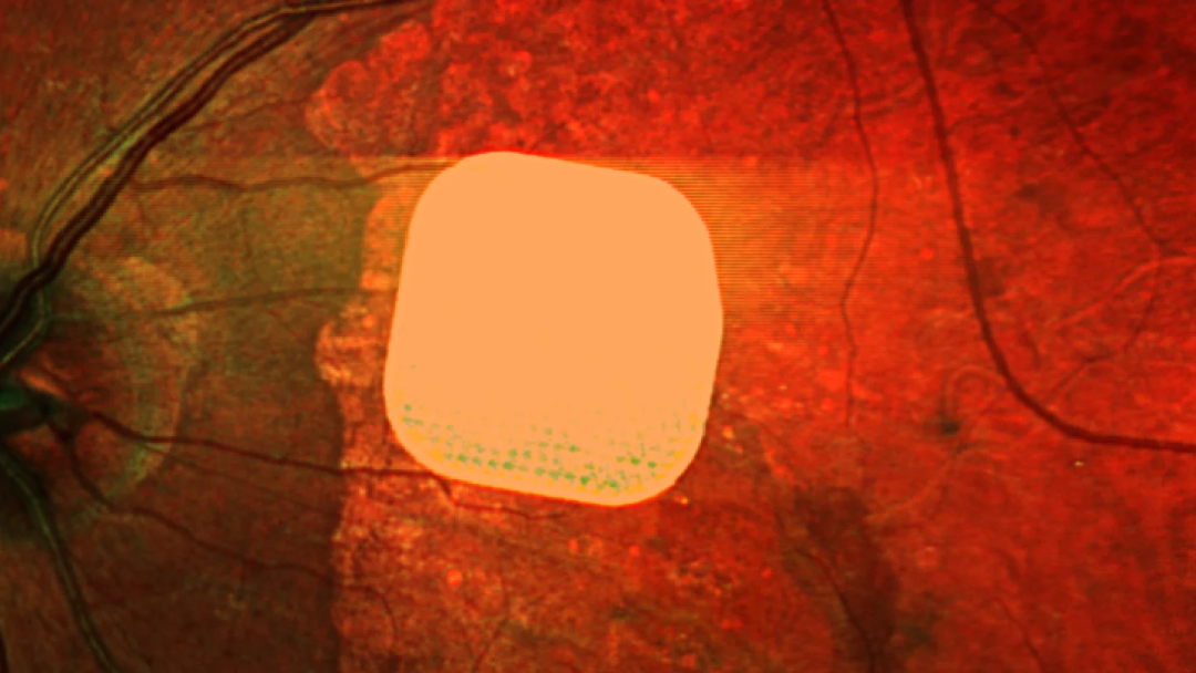 1761128497855072.png