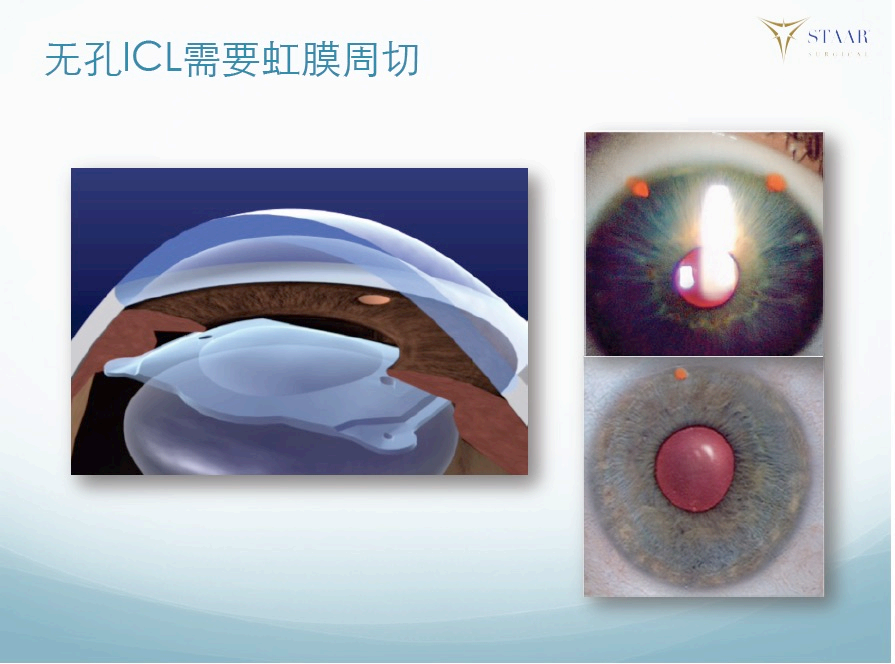 1764831811491667.png 640 (23).png