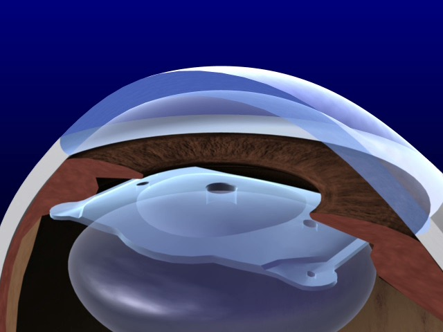 1764831996924804.png 640 (25).png