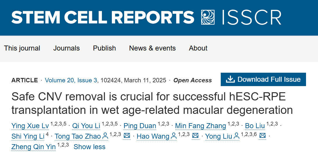 2025年眼科研究十大突破 2025年眼科研究十大突破