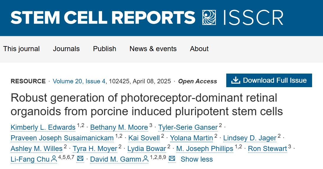 2025年眼科研究十大突破 2025年眼科研究十大突破