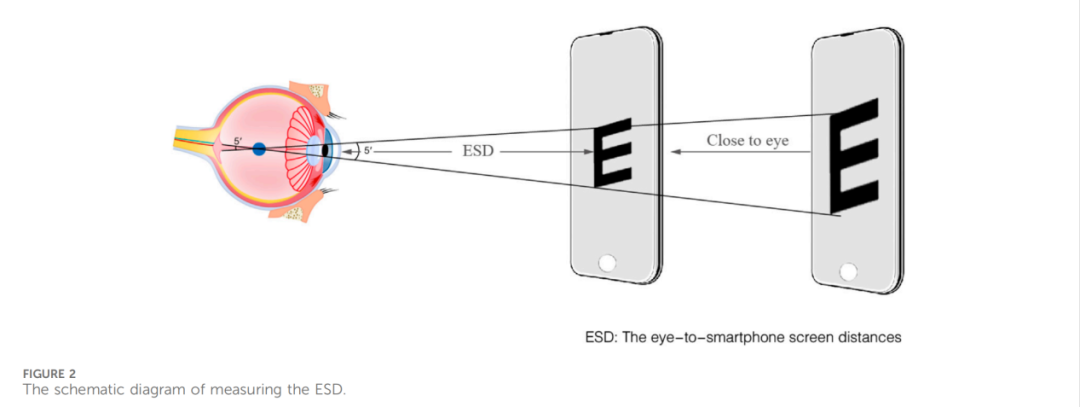 天津医科大学眼科医院视光团队突破性成果：基于智能手机实现居家全参数近视筛查