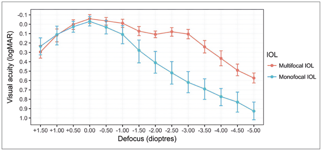 人工晶状体光学设计新时代的探索