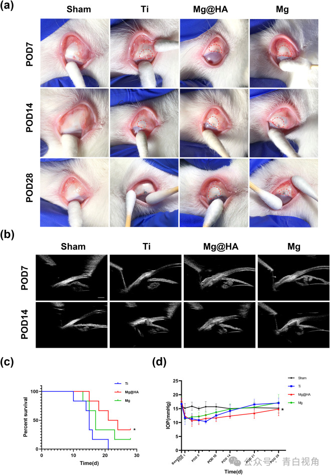 合同金额达1500万元丨全球首创可降解青光眼引流装置成功转化
