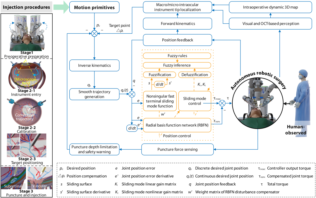 球首个机器人实现全自主视网膜靶向注射
