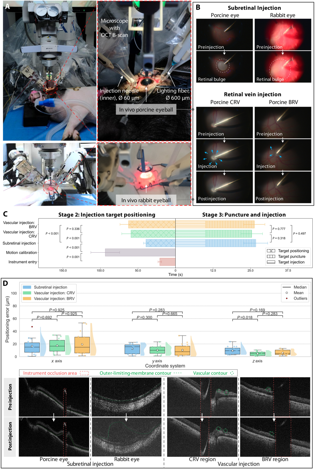 球首个机器人实现全自主视网膜靶向注射