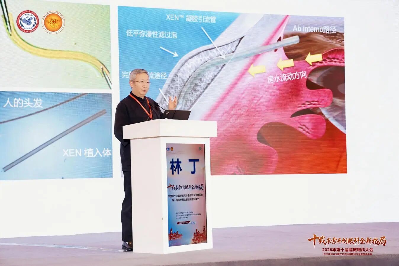 爱尔眼科医院集团院长林丁作《实践与思考--微引流管植入术流体力学及临床回顾性分析》专题分享 爱尔眼科医院集团院长林丁作《实践与思考--微引流管植入术流体力学及临床回顾性分析》专题分享