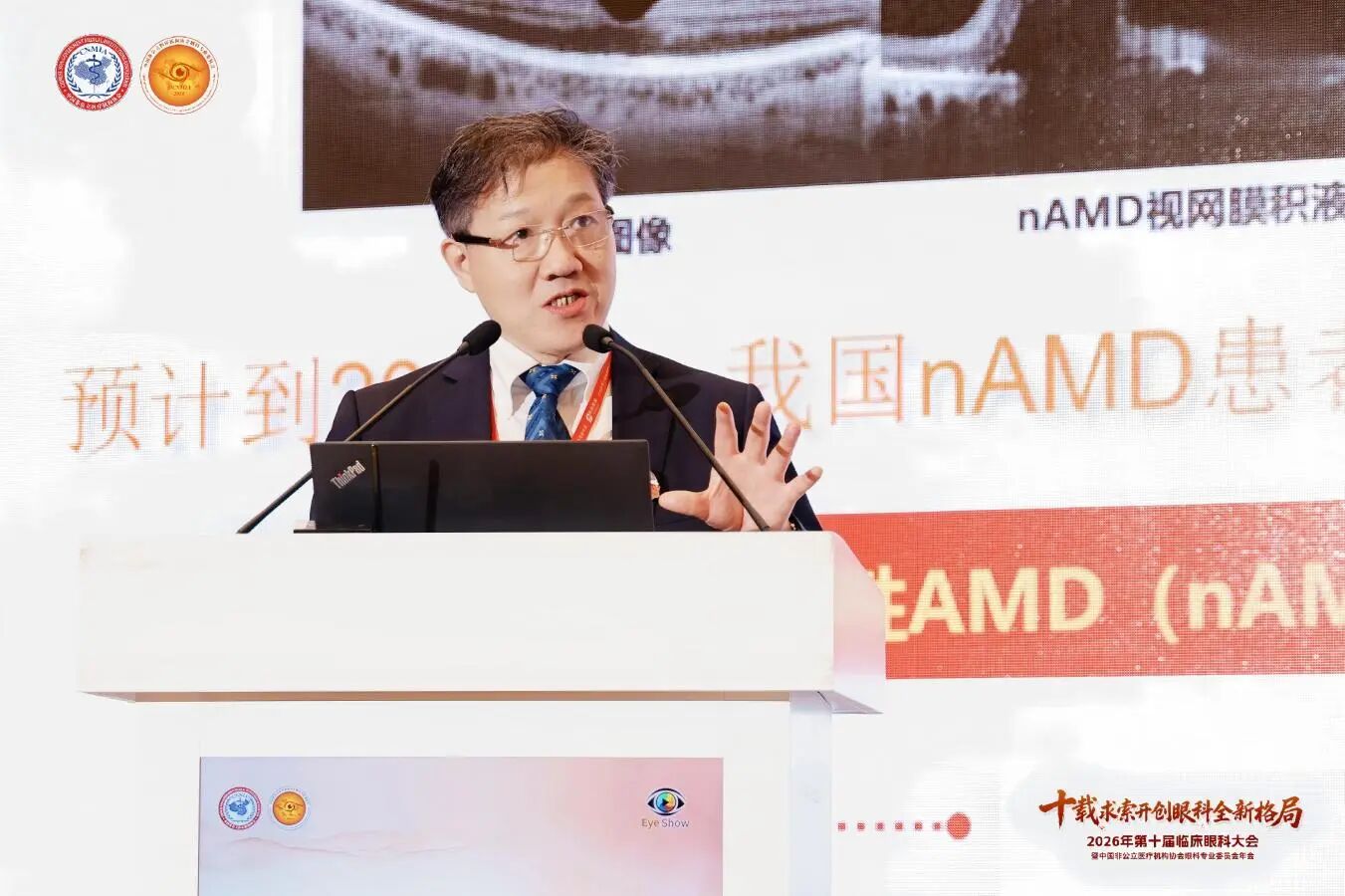 中国医学科学院北京协和医院陈有信教授作《老年黄斑变性的疗效AI研究》主题报告 中国医学科学院北京协和医院陈有信教授作《老年黄斑变性的疗效AI研究》主题报告